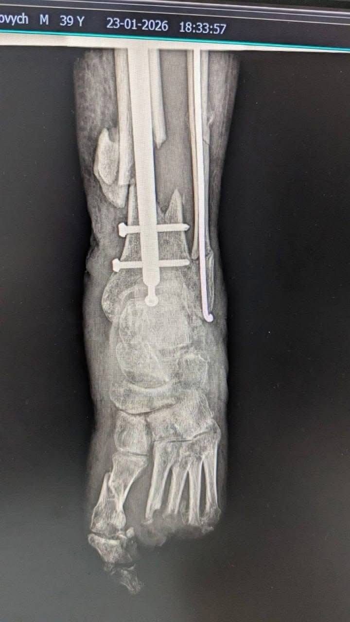 фото: пацієнт